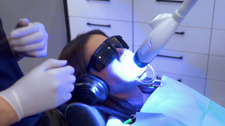 teeth whitening chairside blue light