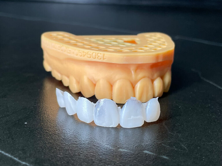 smile makeover trial smile