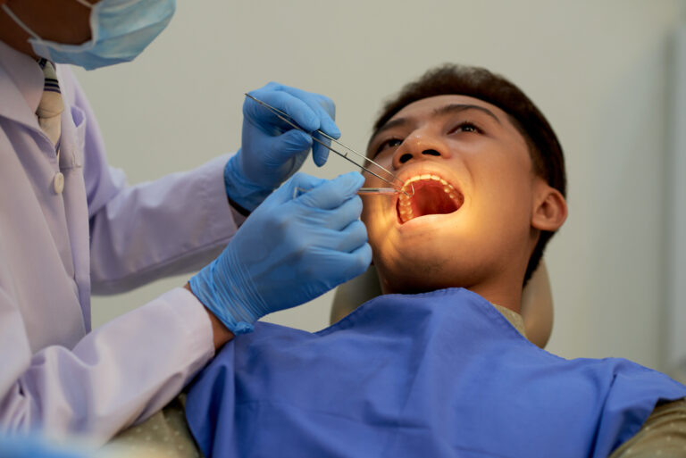 Inlay and Onlay: Durable Dental Restorations in Singapore