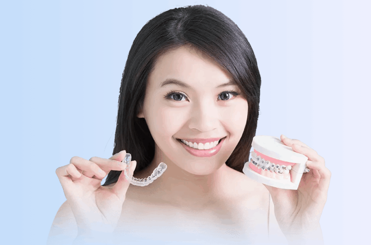 Invisalign vs. Braces in Singapore