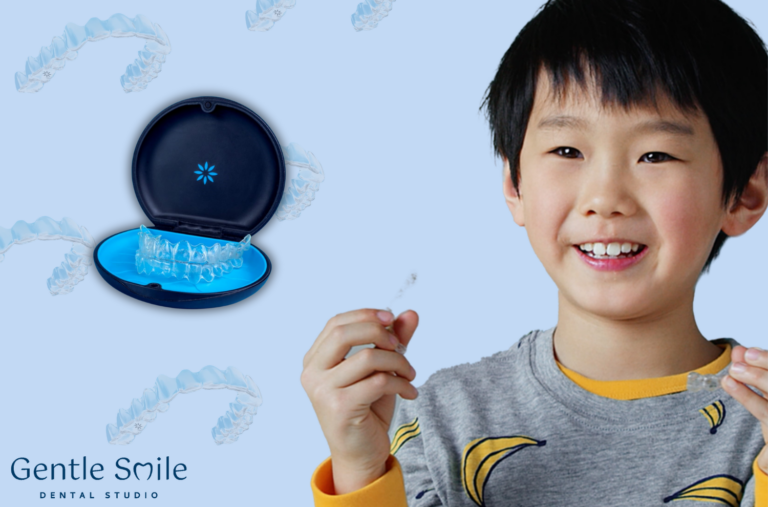 Invisalign for Kids: Why Singaporean Parents are Choosing Clear Aligners for Primary Schoolers